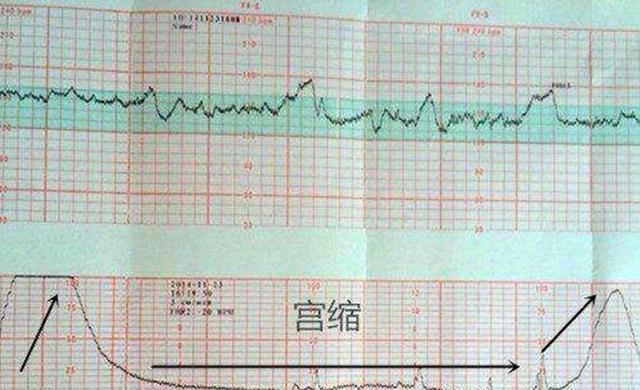 几个月可以自己测胎心？了解孕期胎心监测的重要性与正确方法